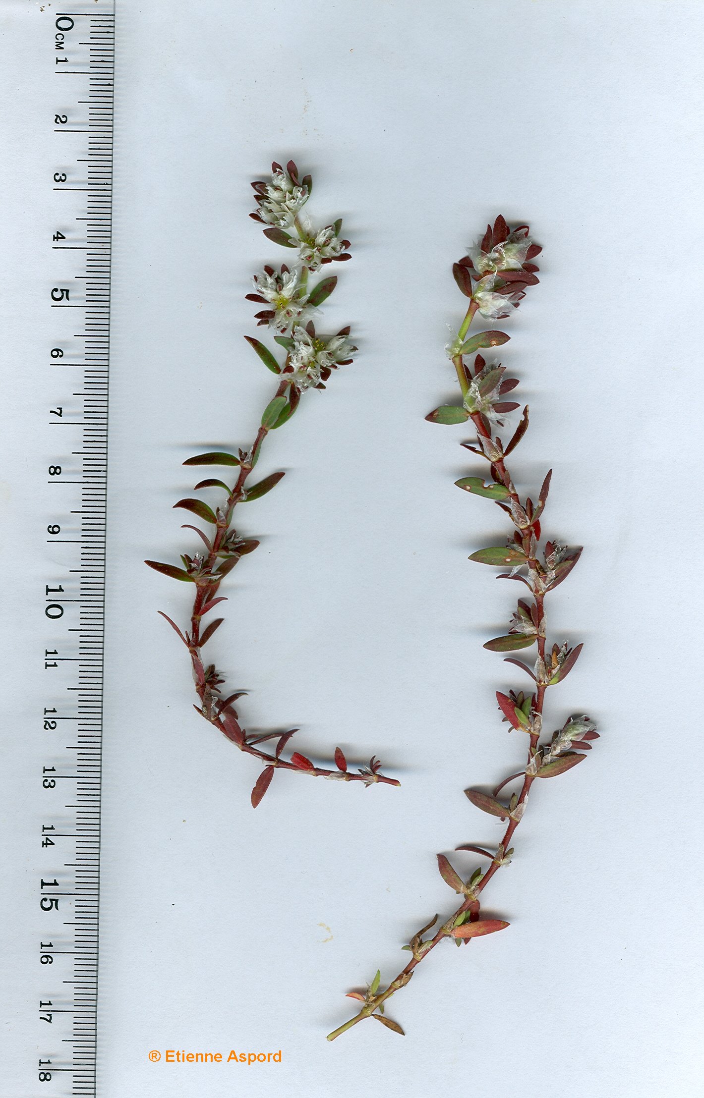 paronychia argentea