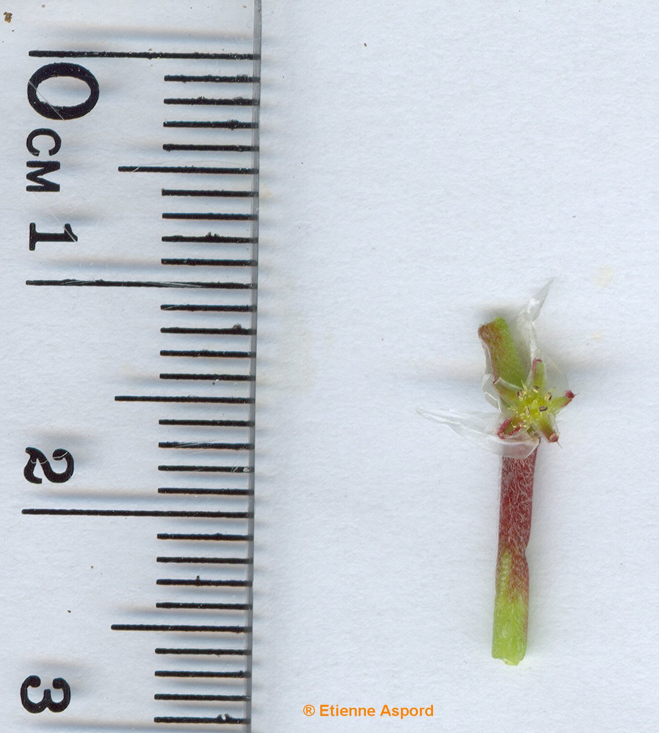 paronychia argentea